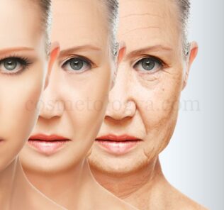 criteria aging Критерии: естественное старение, фотостарение