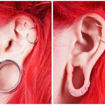 i 6 Коррекция мочки уха